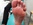 Painful for patient on long walks